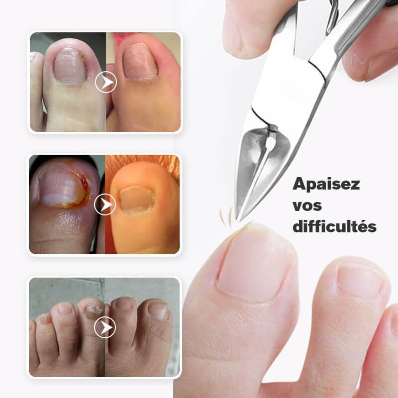 Coupe-ongles de qualité médicale pour une coupe précise et hygiénique