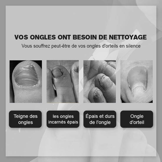 Coupe-ongles de qualité médicale pour une coupe précise et hygiénique