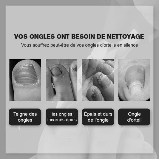 Coupe-ongles de qualité médicale pour une coupe précise et hygiénique