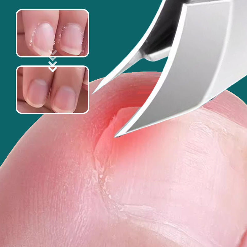 Set de 3 coupe-ongles avec bord incliné à 25°, conception anti-éclaboussures pour une utilisation facile et propre en 2025